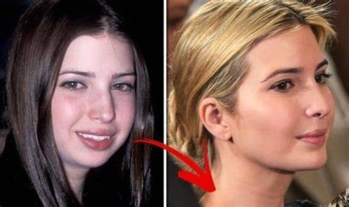 12 Disturbing Before And After Photos Of The Trumps Social News Daily