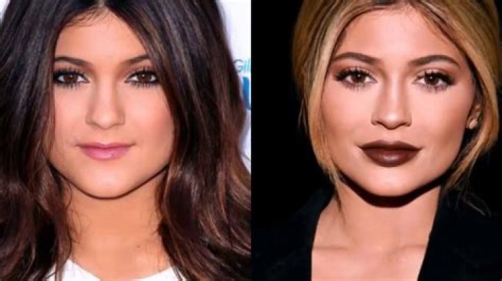 13 Of The Most Drastic Celebrity Plastic Surgeries