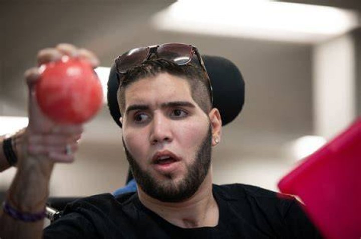 16 Surprising Facts About Prichard Colon