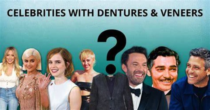 20 Celebrities with Veneers Just Like Us Regular People