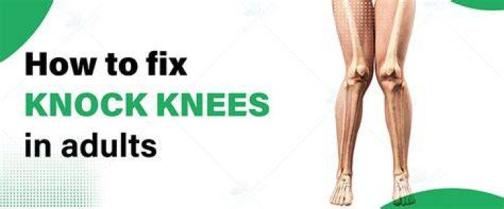 26 best Knock Knees images on Pinterest Celebs, Hiphop and