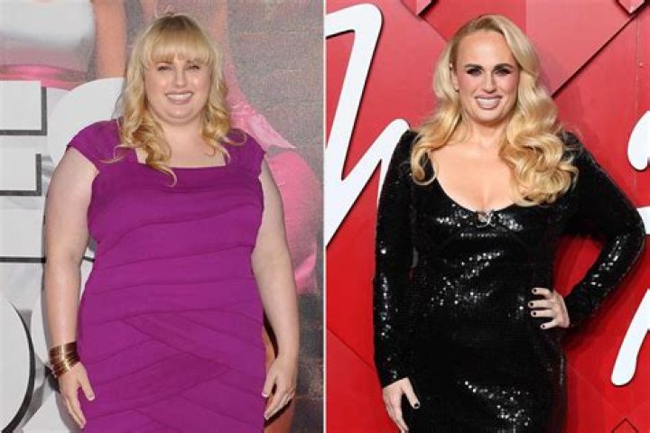 5 Celebrities Who Had Weight Loss Surgery
