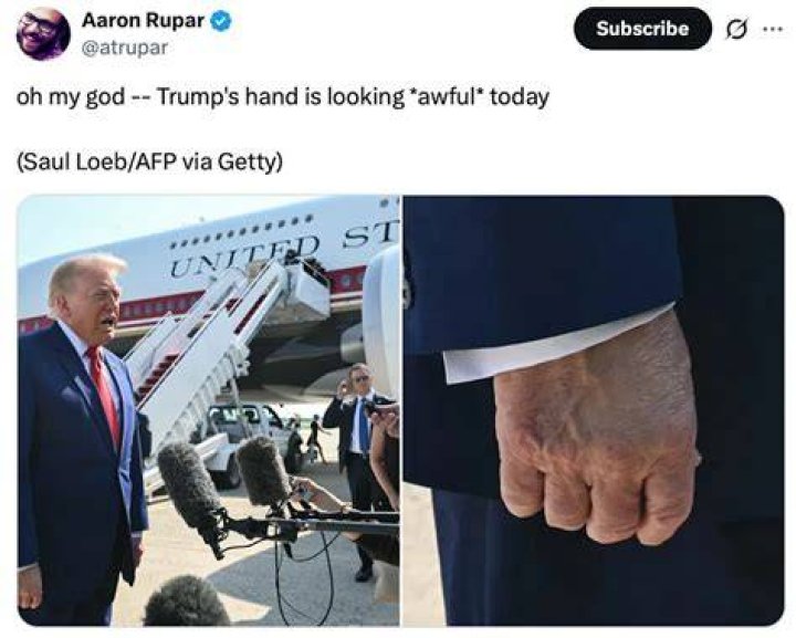 Aaron Rupar's Twitter account suspended along with list of other