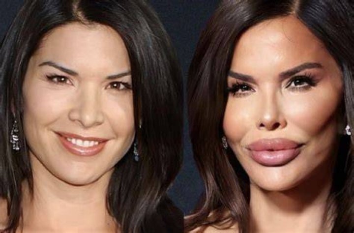 About Chloe Ting Plastic Surgery : Before and After