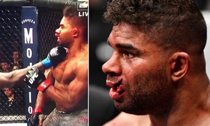 Alistair Overeem Injured and out of UFC 160 Fight Against Junior Dos