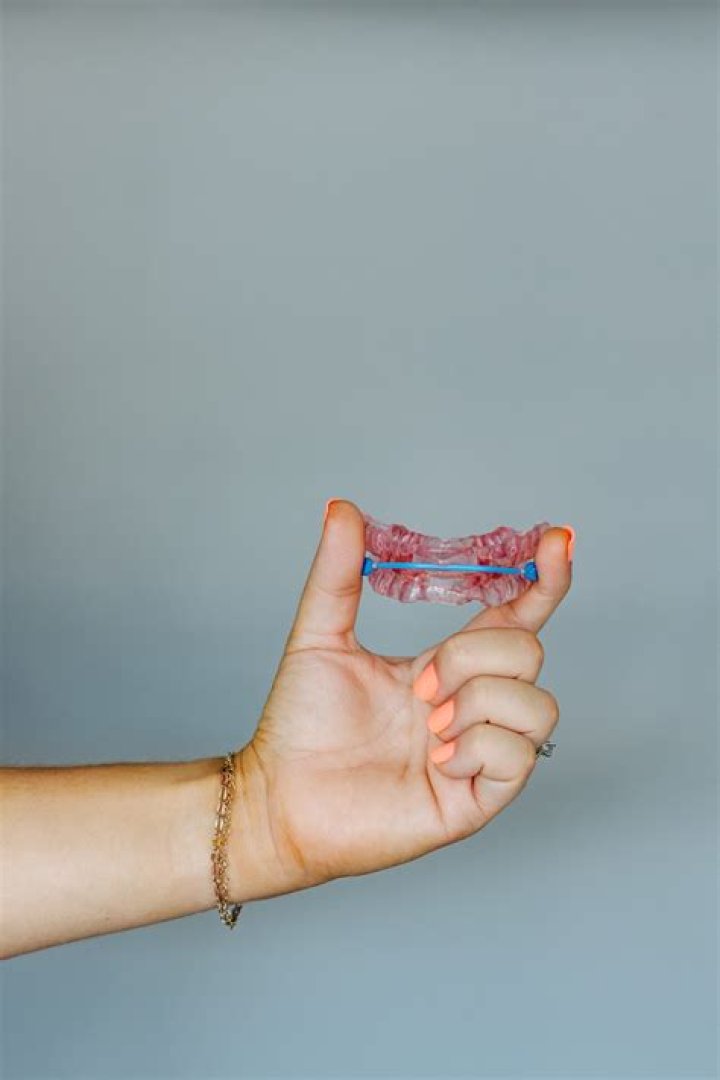 Alumni&rsquo;s customfit oral devices help Hoosiers breathe easier IU News