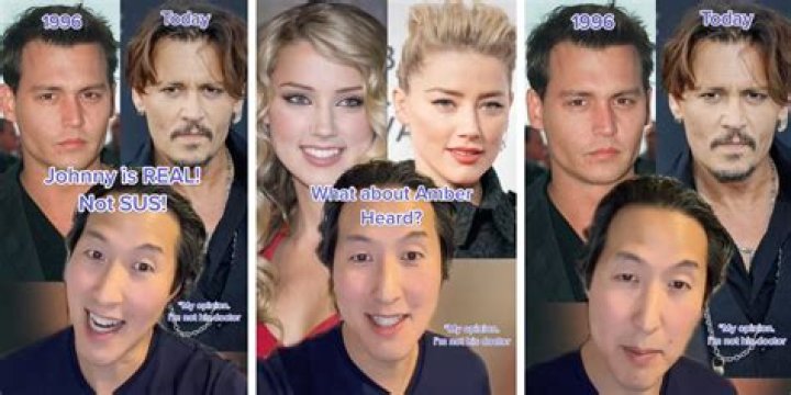 Amber Heard plastic surgery TikTok plastic surgeon reveals Johnny Depp