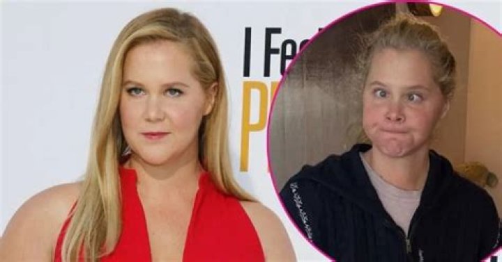 Amy Schumer pokes fun at herself as she shares childhood Instagram with