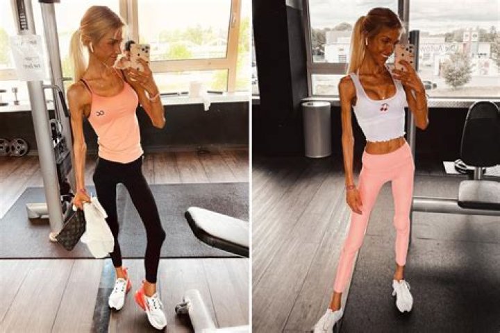 Anorexic influencer dies of heart failure aged 24 after sharing her