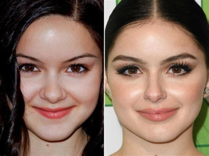 Ariel Winter Nose Job Sự Thay Đổi Gương Mặt Đ&aacute;ng Ngạc Nhi&ecirc;n
