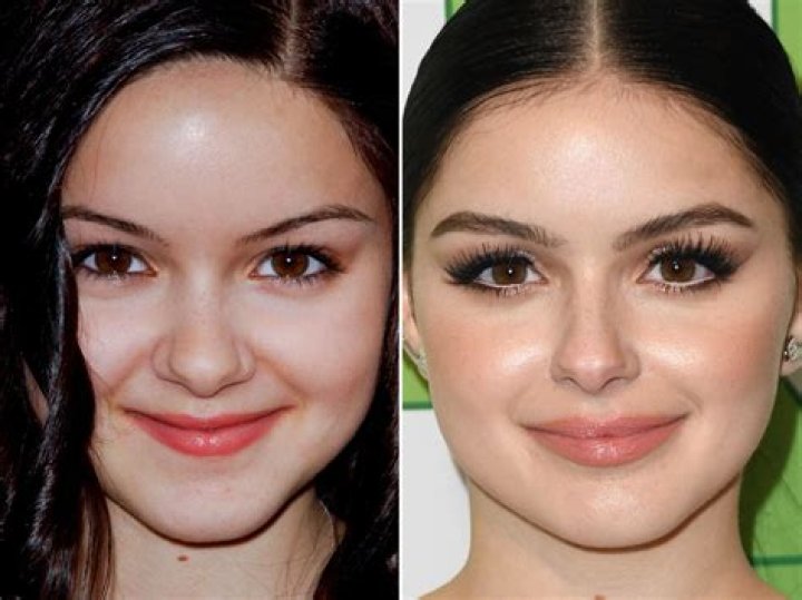 Ariel Winter Pre Surgery Pics