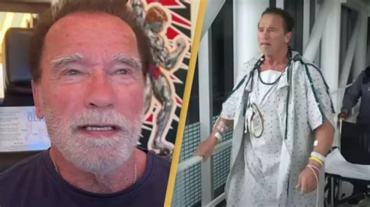 Arnold Schwarzenegger Nose Surgery And Botox Before After