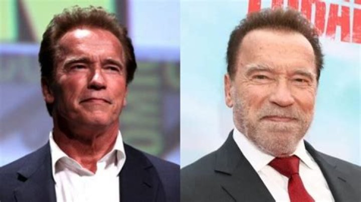 Arnold Schwarzenegger&rsquo;s Plastic Surgery Botox, Jaw Reduction, Eyelid