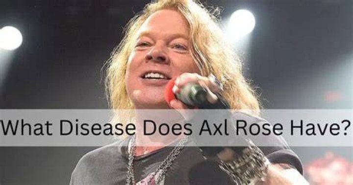 Axl Rose’s Illness, and Health Recovery 2023 How the Rock Legend