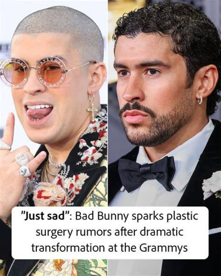 Bad Bunny&rsquo;s Plastic Surgery The 29YearOld Rapper Looks A Little