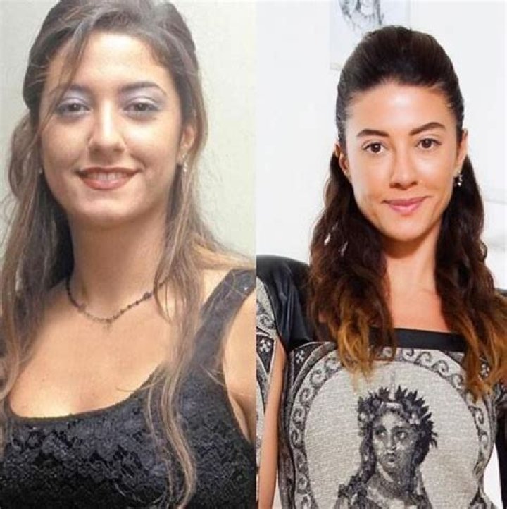 Basak Dizer Estetiksiz Hali