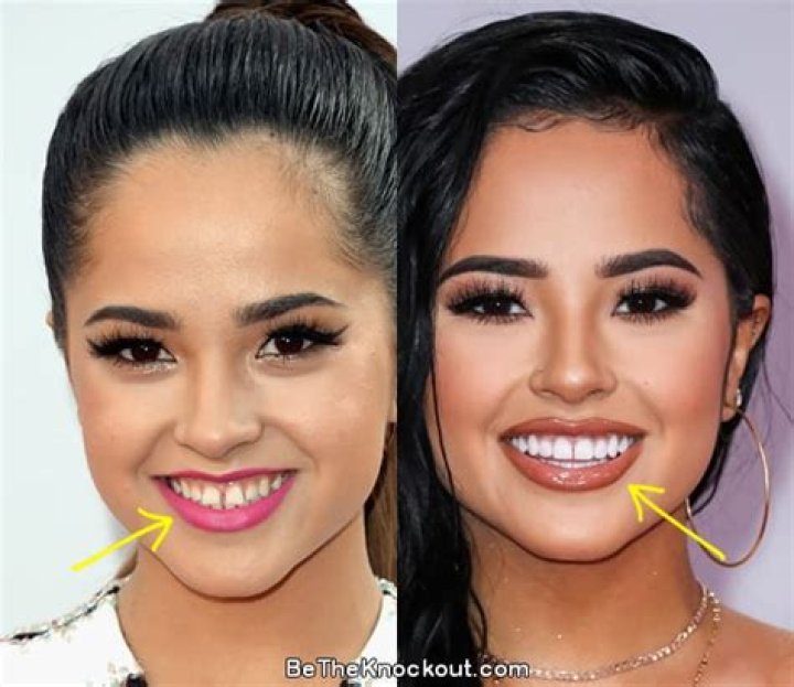 Becky G Plastic Surgery Comparison Photos