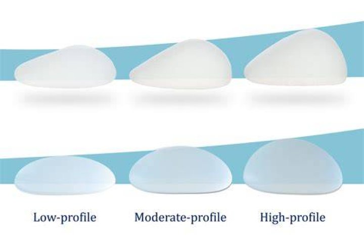 BIGGER Breast Implants In New Instagram Photos?