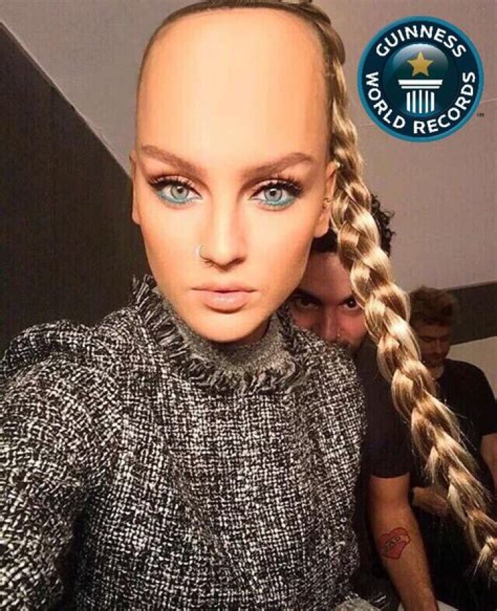 Biggest forehead in the world woahdude