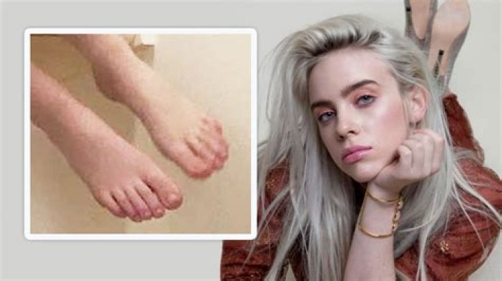 Billie Eilish Bare Feet For Rolling Stone (19 Photos) The Fappening