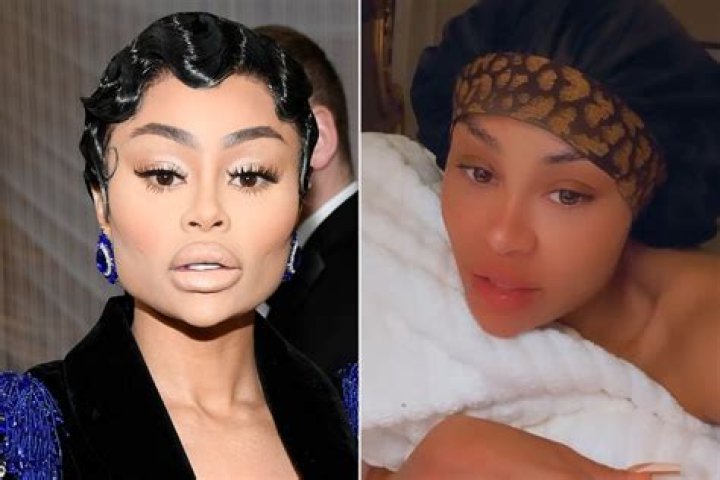Blac Chyna Removes Ink