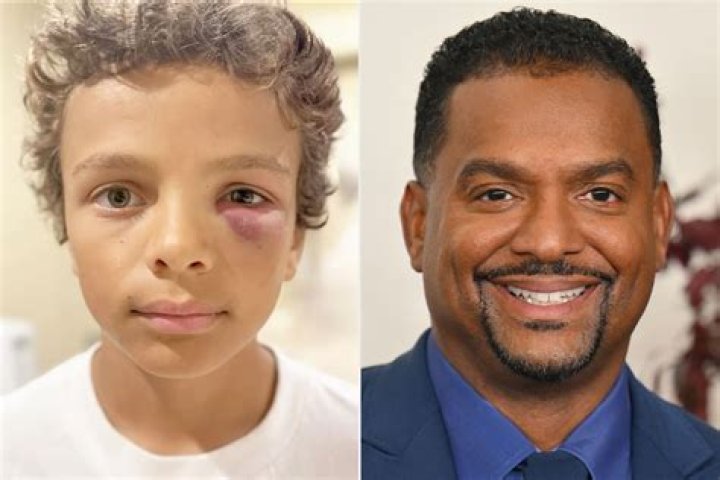 Black Kudos • Alfonso Ribeiro Alfonso Lincoln Ribeiro (born...