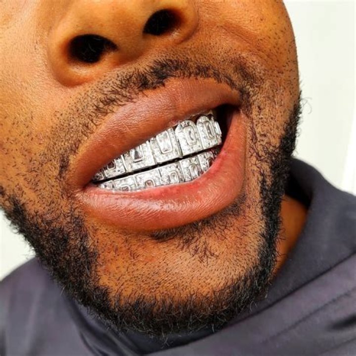 Braces That Look Like Grills