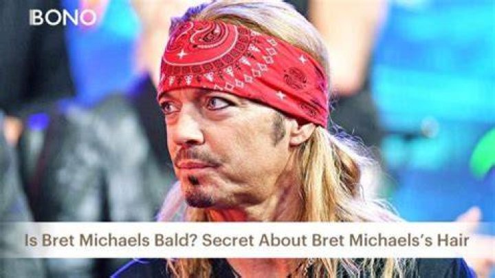 Bret Michaels&rsquo; Hair Is Bret Michaels Bald?