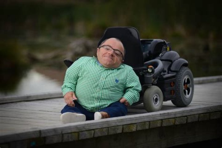 Brittle bone adventurer Samuel Gibson dies after suffering head injury