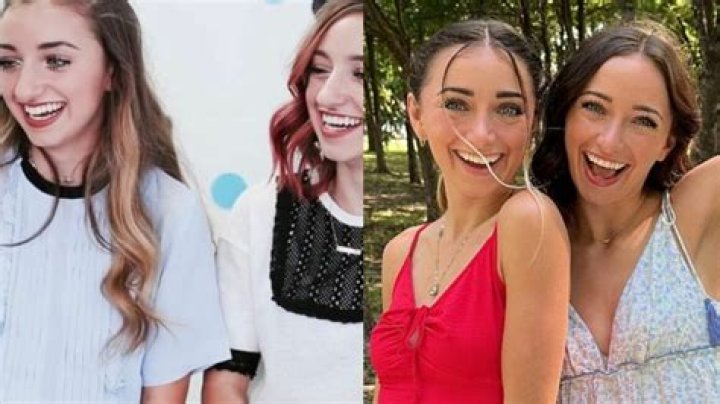 Brooklyn and Bailey Nose Job Reddit Users Examine Their Before and