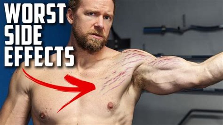 Buff Dudes Share The Worst Side Effects of Bodybuilding No One Wants To