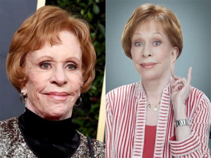 Carol Plastic Surgery With Before And After Photos