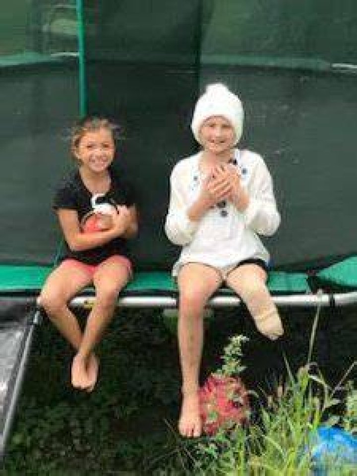 Caylee Blosenski prosthetic leg Caylee Blosenski prosthetic leg