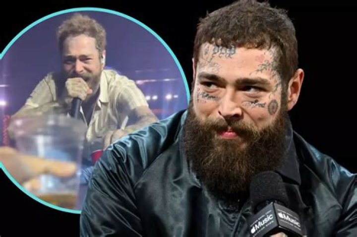 &ccedil;&ouml;p&ccedil;atan Uyarı Meksika post malone face