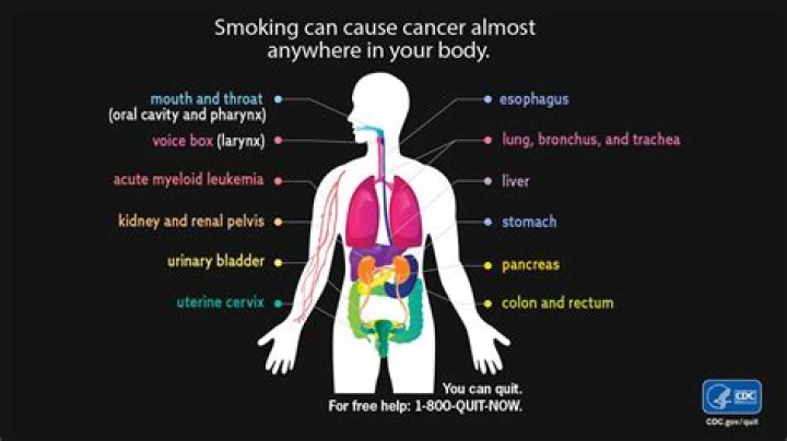 CDC Airport smoking areas unhealthy, even if you're not in them Sun