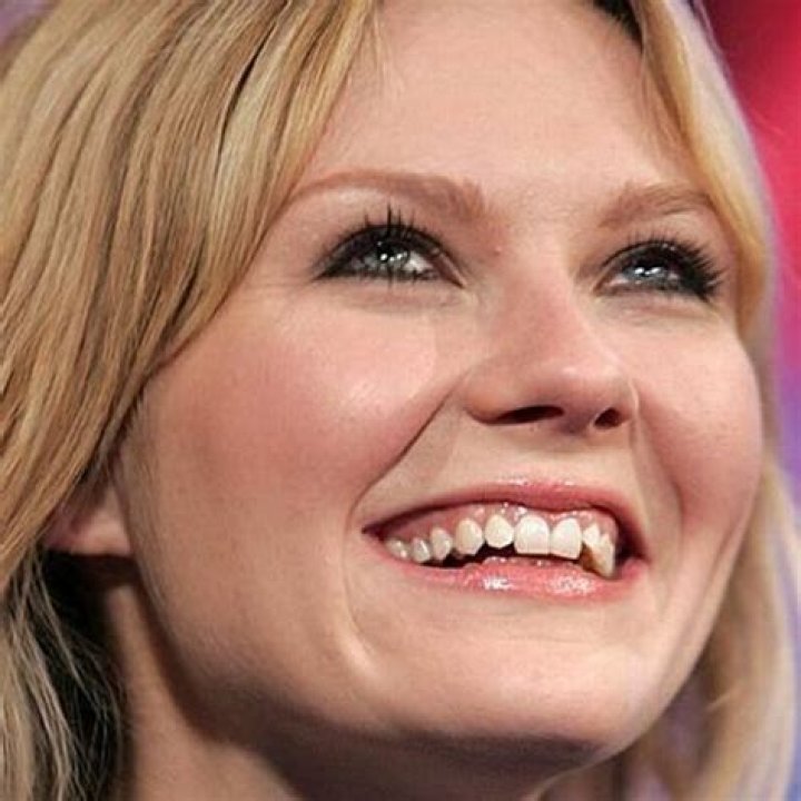Celebrities with Bad Teeth (13 pics)