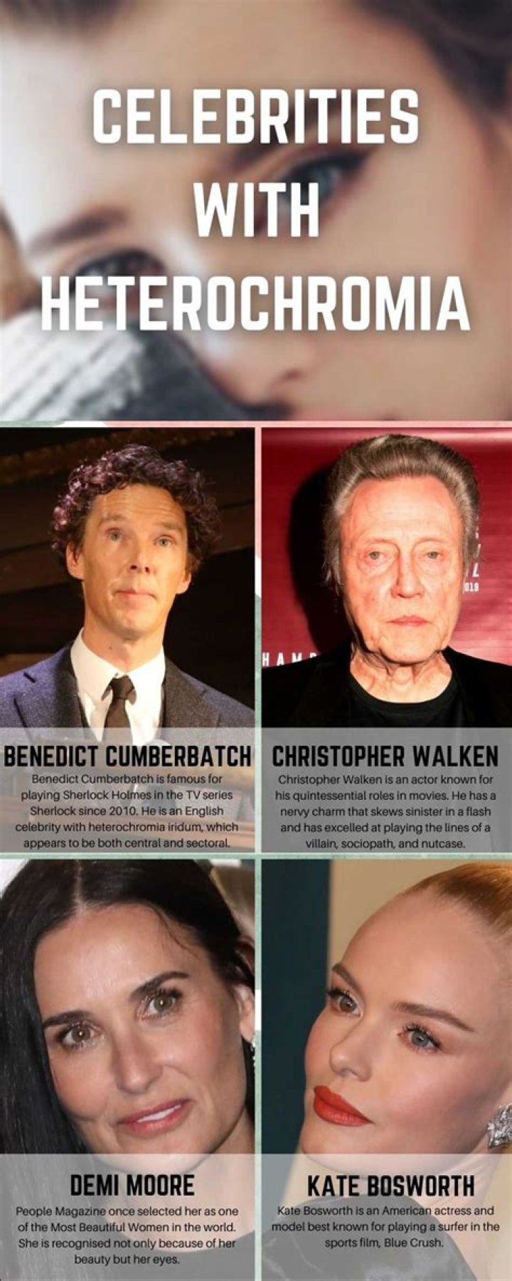 Celebrities with Heterochromia List of Famous People with Different