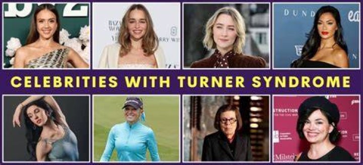 Celebrities With Turner Syndrome And Their Inspiring Journeys