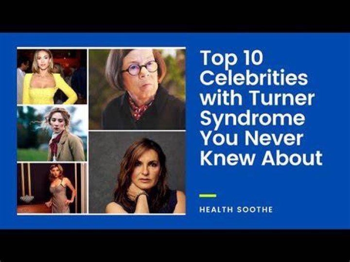 Celebrities With Turner Syndrome Health Guide Net