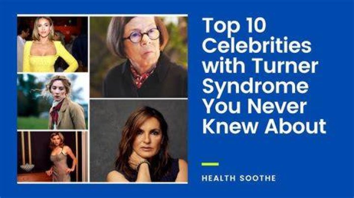 Celebrities With Turner Syndrome Video Bokep Ngentot