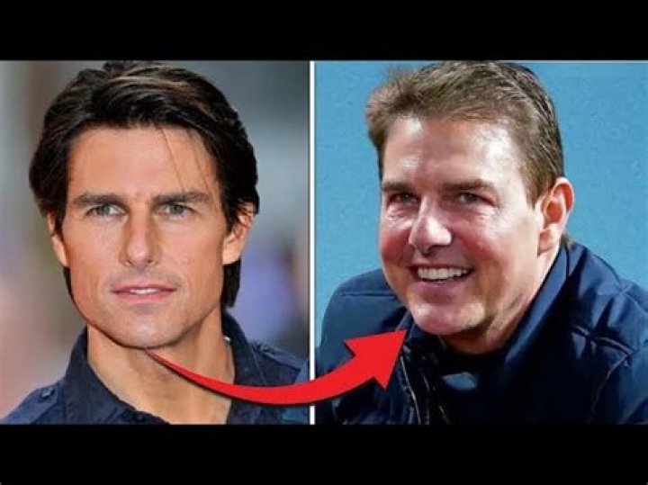 Chatter Busy Tom Cruise Nose Job