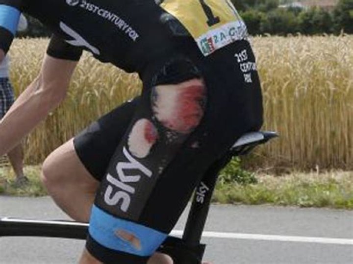 Chris Froome injury nightmare continues with freak kitchen knife
