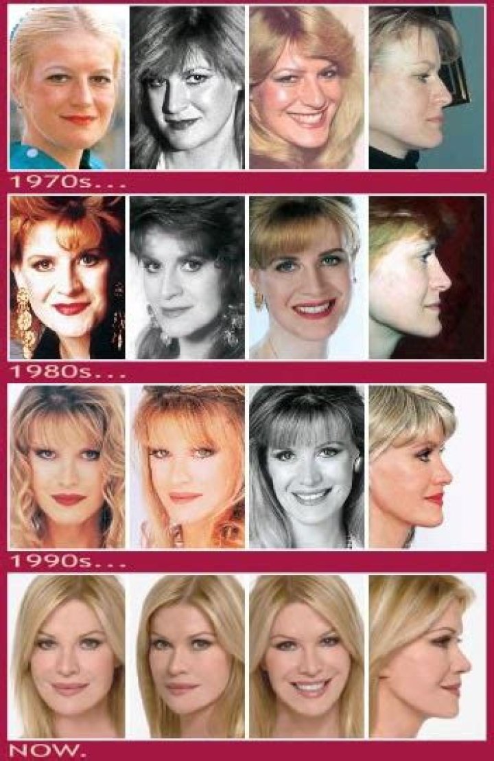 Cindy Jackson, American plastic surgery pioneer and bestselling author