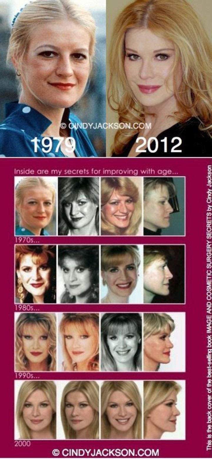 Cindy Jackson biography. Cosmetic surgery and antiaging pioneer.