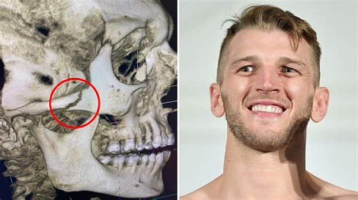 dan hooker x ray