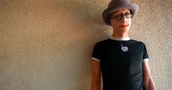 Dave Dave, Artist Disfigured After Father Set Him on Fire in O.C., Died