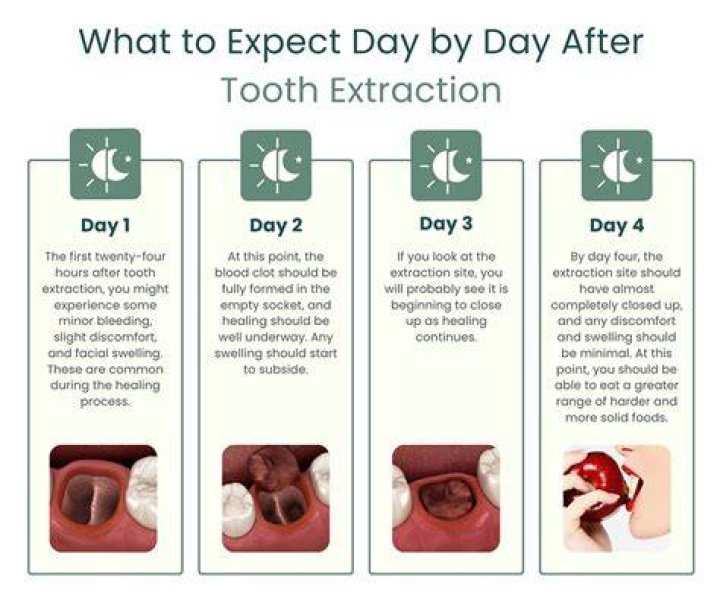 Day 3 after extractions and immediate Dentures YouTube