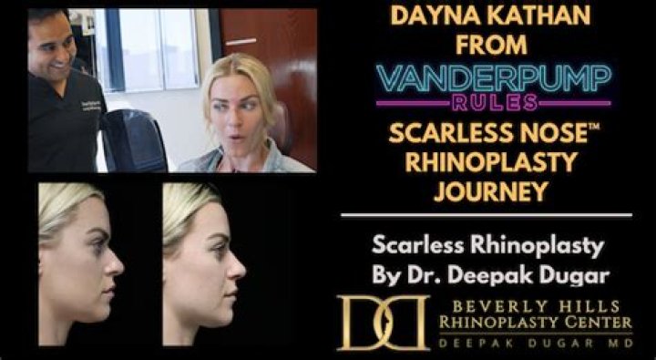 Dayna Kathan Responds to Nose Job Insults Vanderpump Rules The Daily