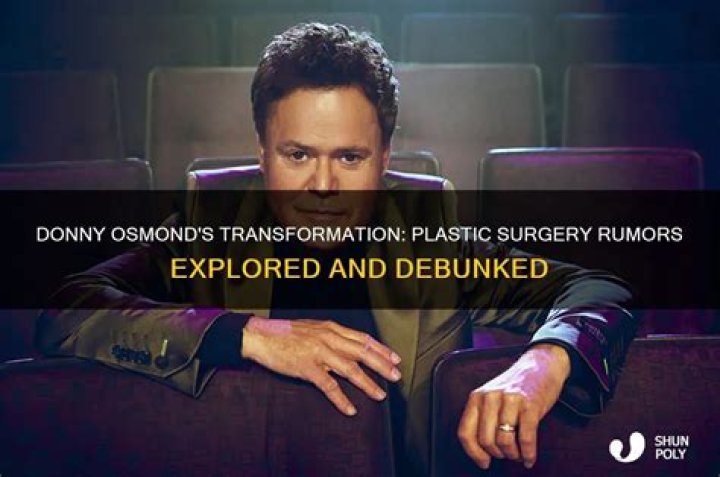 Did Donny Osmond Have Plastic Surgery? Everything You Need To Know