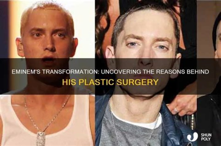 Did Eminem Get Plastic Surgery?
